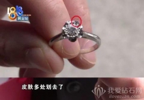 钻戒划伤皮肤，工艺缺陷还是正常现象？