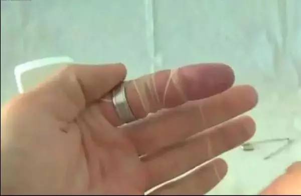 戒指和手镯取不下来